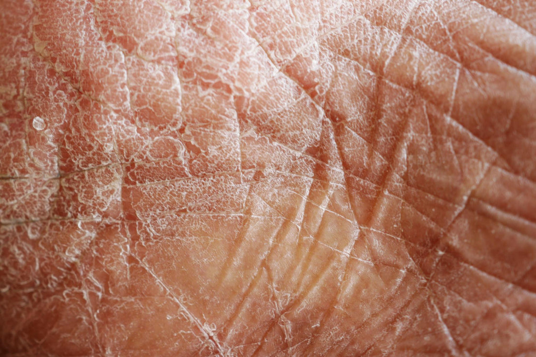 Diabetes & Your Skin: Choosing Safe, Supportive Facial Treatments